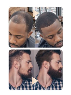 MELT NUSKIN HUMAN HAIR FIBERS FOR MEN - Image 5