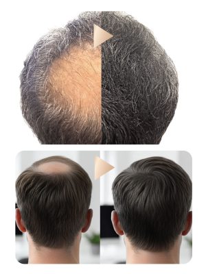 MELT NUSKIN HUMAN HAIR FIBERS FOR MEN - Image 6